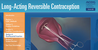Long-Acting Reversible Contraception