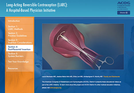 Long-Acting Reversible Contraception