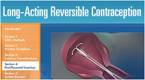 Long-Acting Reversible Contraception
